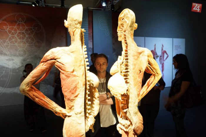 Ilustračný obrázok k článku Lekári sú proti výstave, ktorá ukazuje mŕtve ľudské telá. Je vraj nezákonná